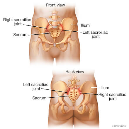 sacroiliac ligament pain